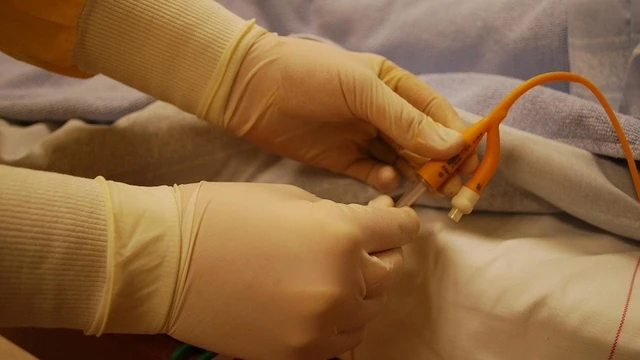 bai-viet/quy-trinh-va-chi-dinh-dat-sonde-tieu-nu.html