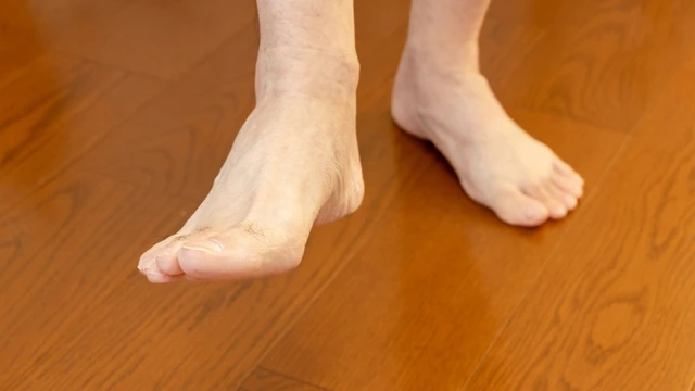 bai-viet/ra-mo-hoi-chan-nhieu-do-dau-cach-khac-phuc-the-nao.html