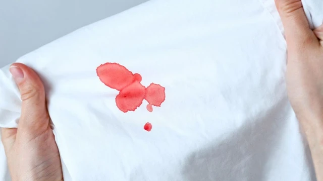 bai-viet/rach-mang-trinh-chay-mau-bao-lau-nu-gioi-can-biet-de-tranh-lo-lang.html