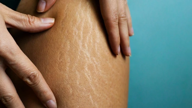 bai-viet/nhung-dieu-can-biet-ve-ran-da-chan-o-ba-bau-57713.html