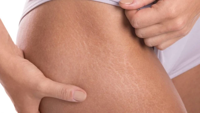 bai-viet/nguyen-nhan-va-cach-khac-phuc-tinh-trang-ran-da-dui.html