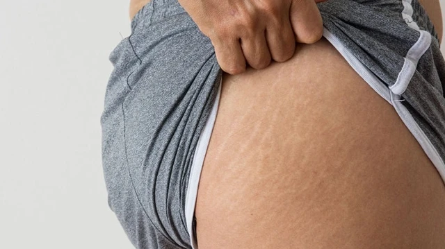 bai-viet/ran-da-mong-o-nam-tim-hieu-nguyen-nhan-va-cach-dieu-tri-57124.html