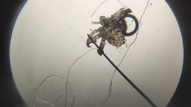 bai-viet/ran-mu-lay-qua-duong-gi-64348.html