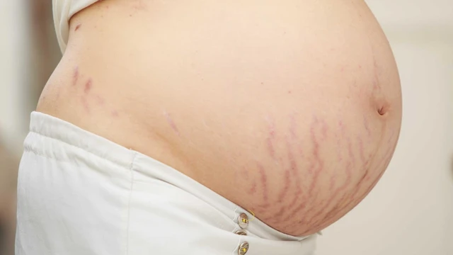 bai-viet/ran-nut-da-nguyen-nhan-va-cac-phuong-phap-dieu-tri-65100.html