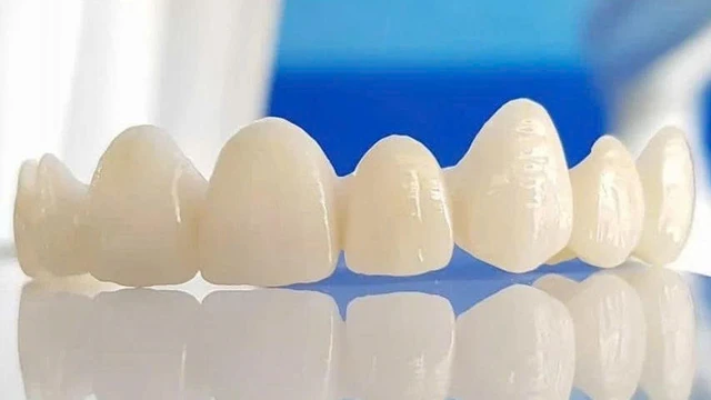 bai-viet/rang-su-khi-ve-gia-co-dam-bao-do-ben-va-an-toan-hay-khong.html