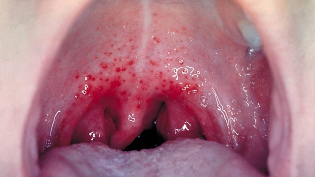 bai-viet/ban-co-biet-rat-co-hong-uong-gi-de-cam-thay-de-chiu-hon-chua.html