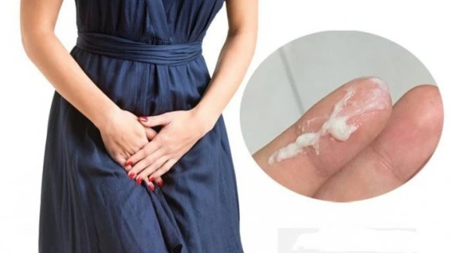 bai-viet/rau-nhut-co-tri-huyet-trang-duoc-khong-cac-mon-an-giup-tri-benh-huyet-trang.html