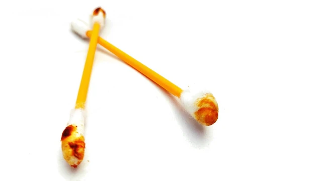 bai-viet/ray-tai-kho-cung-can-xu-ly-the-nao.html