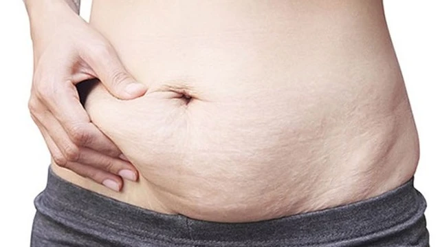 bai-viet/tim-hieu-ve-uu-nhuoc-diem-cua-cach-xoa-ran-da-sau-sinh-57024.html