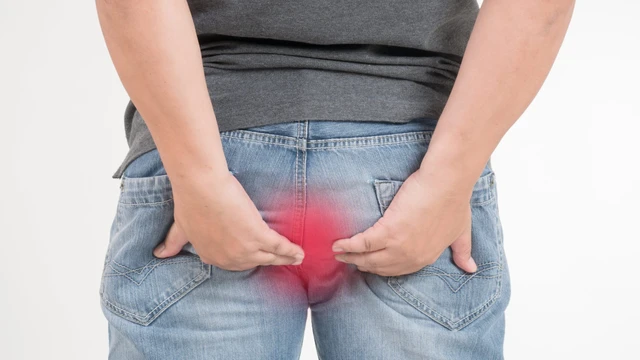 benh/khe-nut-va-lo-ro-hau-mon-truc-trang-121.html