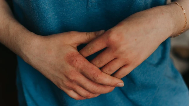 bai-viet/roi-loan-chuyen-hoa-porphyria-va-nhung-thong-tin-can-biet.html