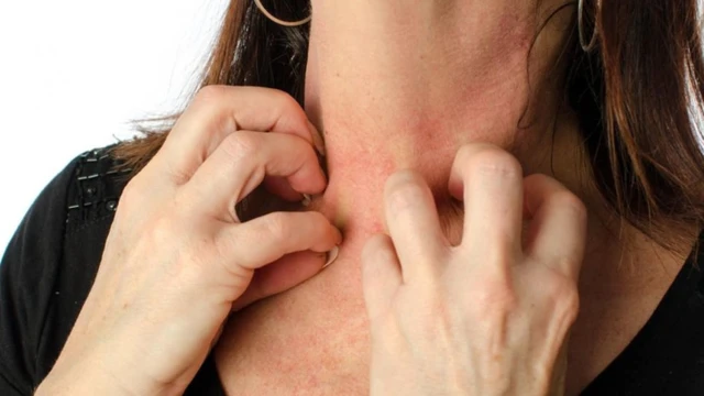 bai-viet/rom-say-o-co-nguyen-nhan-trieu-chung-va-cach-dieu-tri.html