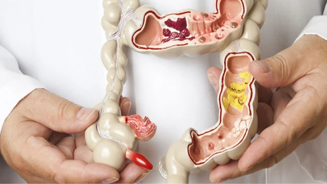 bai-viet/sa-truc-trang-o-tre-em-la-gi-co-nguy-hiem-khong-62984.html