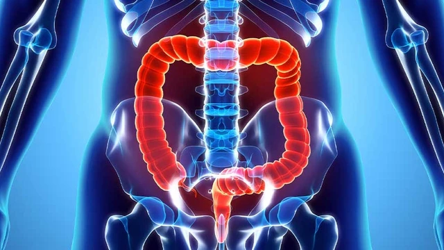 bai-viet/sa-truc-trang-va-tri-co-giong-nhau-khong-cach-phan-biet.html