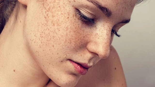 bai-viet/sam-da-co-nen-phoi-nang-khong-nhung-phuong-phap-ho-tro-cai-thien-sam-da.html