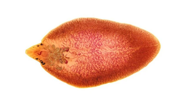 bai-viet/san-la-gan-lon-nguyen-nhan-trieu-chung-va-chan-doan.html