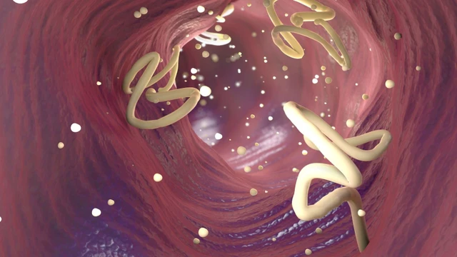 bai-viet/san-lon-chet-o-nhiet-do-bao-nhieu-chan-doan-va-cach-dieu-tri-khi-bi-nhiem-san-lon.html