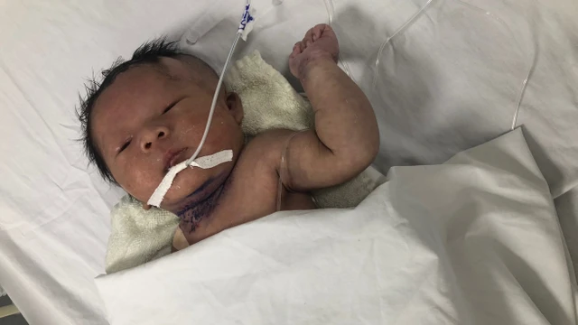 bai-viet/sang-loc-roi-loan-chuyen-hoa-bam-sinh-bang-msms-la-gi.html