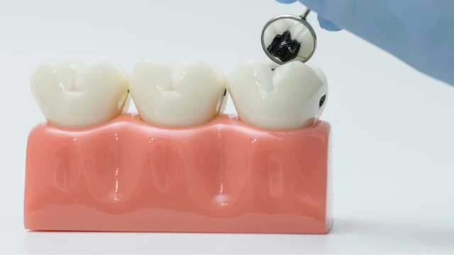 bai-viet/sau-rang-ham-trong-cung-la-rang-nao-nguyen-nhan-va-cach-dieu-tri.html