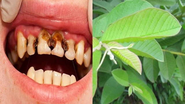 bai-viet/thuc-hu-kinh-nghiem-sau-rang-uong-cay-gi.html