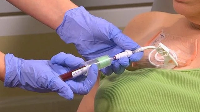 bai-viet/scv-o2-la-gi-hieu-ro-khai-niem-va-y-nghia-trong-viec-danh-gia-tinh-trang-suc-khoe.html