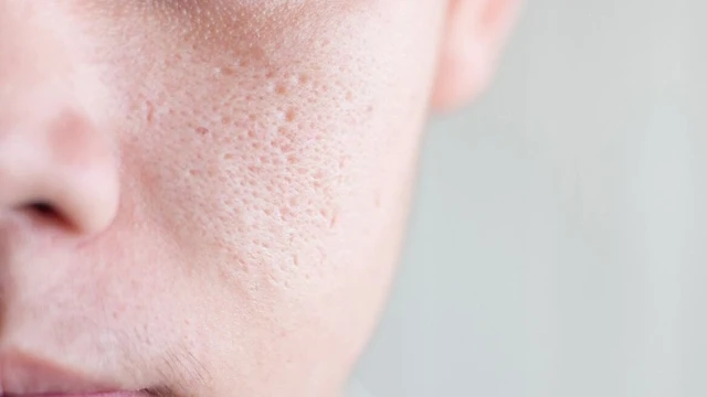 bai-viet/meo-se-khit-lo-chan-long-cho-nam-gioi-khong-the-bo-qua.html