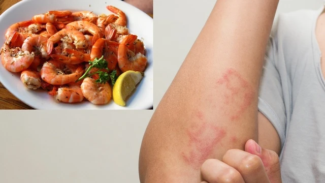 bai-viet/seo-loi-an-tom-co-duoc-khong-54759.html