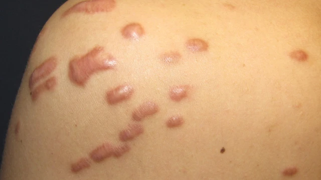 bai-viet/seo-loi-va-seo-phi-dai-khac-nhau-the-nao-57453.html