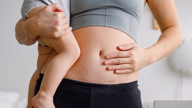 bai-viet/seo-mo-de-qua-trinh-hinh-thanh-nguyen-nhan-va-cach-khac-phuc.html