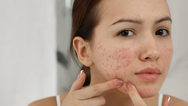 bai-viet/seo-tham-do-nguyen-nhan-va-cach-dieu-tri-seo-nhanh-nhat-62343.html