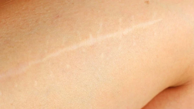 bai-viet/seo-trang-la-gi-cach-phong-ngua-seo-trang-hieu-qua.html