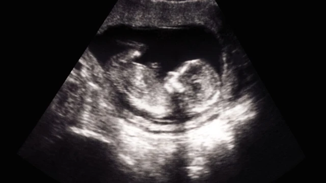 bai-viet/sieu-am-soft-markers-la-gi-sieu-am-soft-markers-bao-nhieu-tien.html