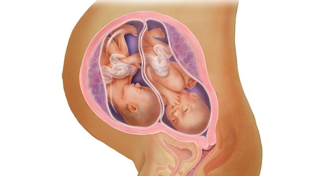 bai-viet/sinh-doi-cung-trung-va-nhung-dieu-me-nen-biet-67987.html