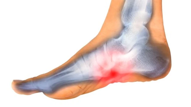 benh/benh-xuong-koehler.html