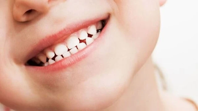 bai-viet/nguyen-nhan-nao-khien-rang-thua-ham-duoi-tac-hai-va-cach-khac-phuc-hieu-qua.html