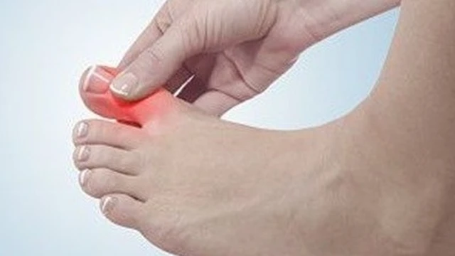 bai-viet/bong-gan-ngon-chan-cai-la-gi-do-dau-xu-ly-nhu-the-nao-52766.html