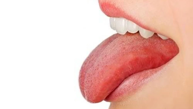 bai-viet/bieu-hien-cua-cac-giai-doan-phat-trien-ung-thu-luoi-ban-khong-nen-bo-qua.html