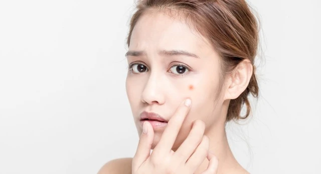 bai-viet/danh-gia-top-6-san-pham-giam-tham-mun-hieu-qua-tren-thi-truong-71800.html