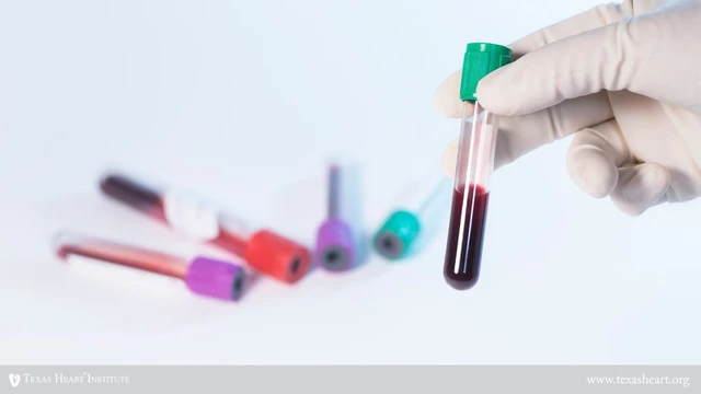 bai-viet/chi-so-triglyceride-tang-do-dau-co-anh-huong-den-mo-mau-khong.html