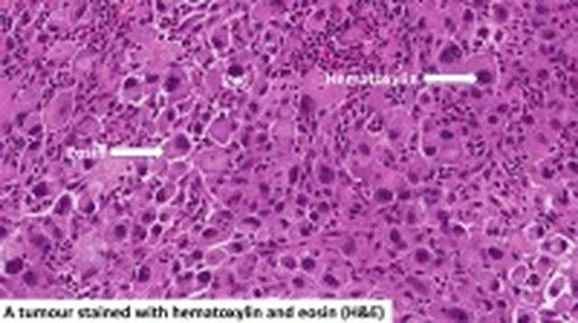bai-viet/phuong-phap-nhuom-2-mau-hematoxylin-eosin-de-lam-gi.html