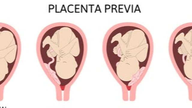 bai-viet/rau-bam-rong-la-gi-phong-ngua-va-loi-khuyen-suc-khoe-cho-thai-phu.html