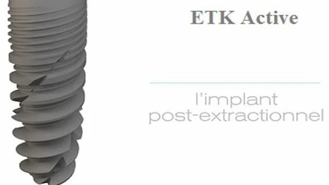 bai-viet/cay-ghep-tru-implant-etk-co-thuc-su-an-toan.html