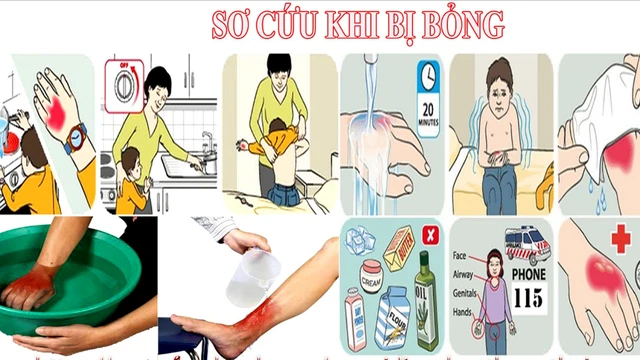 bai-viet/mot-so-truong-hop-so-cuu-bong-sai-cach-ma-nhieu-nguoi-thuong-mac-phai-52183.html
