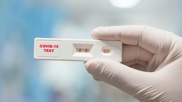 bai-viet/so-cuu-f0-can-luu-y-dieu-gi-57813.html