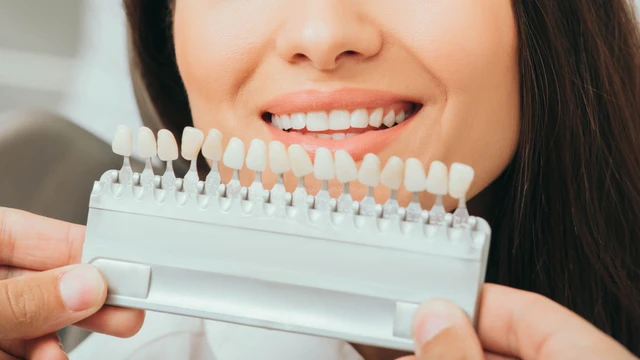 bai-viet/so-sanh-cac-loai-rang-su-nen-chon-loai-nao-cho-phu-hop.html