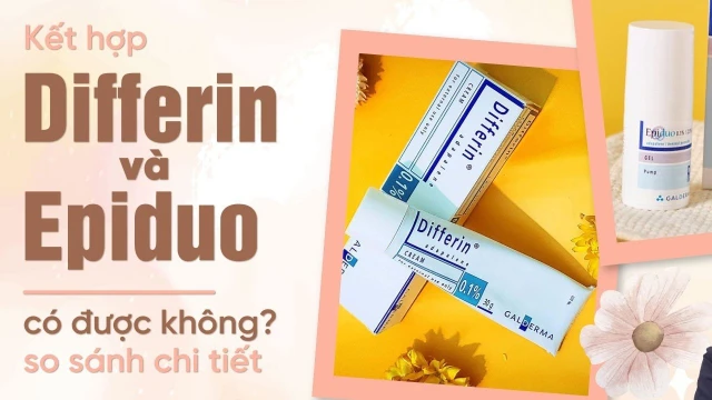 bai-viet/so-sanh-epiduo-va-differin-loai-thuoc-nao-phu-hop-voi-lan-da-cua-ban-hon.html