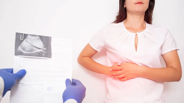 bai-viet/benh-nhan-bi-soi-gan-nen-an-gi-nen-kieng-gi.html