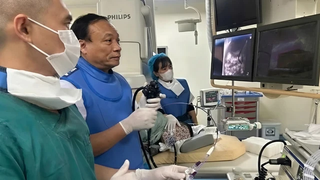 Sỏi ống mật chủ “khủng” 11,5 x 9 mm gây tắc mật nặng ở bệnh nhân 44 tuổi