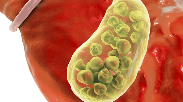 bai-viet/soi-tui-mat-10mm-co-nguy-hiem-khong-qua-trinh-cat-bo-dien-ra-nhu-the-nao.html