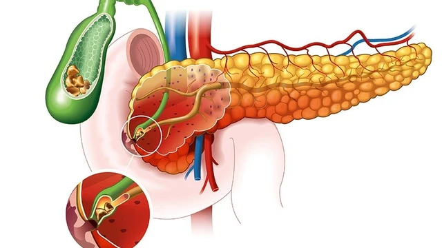 bai-viet/soi-tui-mat-12mm-co-nguy-hiem-khong-lam-gi-khi-bi-soi-tui-mat-12mm.html